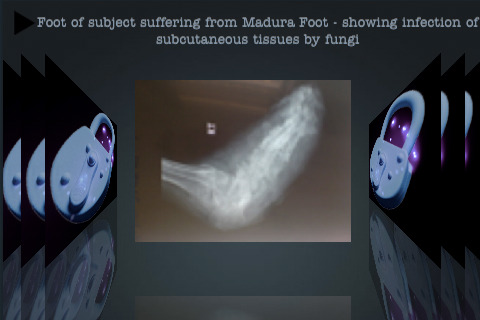 X-rays