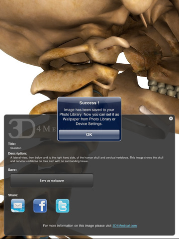 3D4Medical's Images