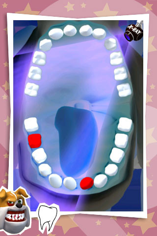 Ali's Teeth Out
